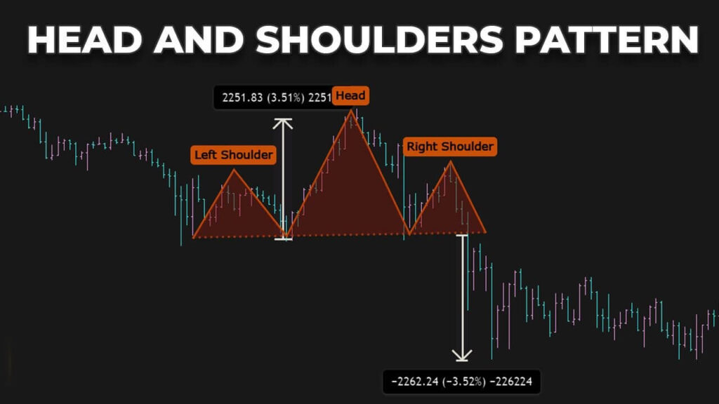 الگوی سر و شانه